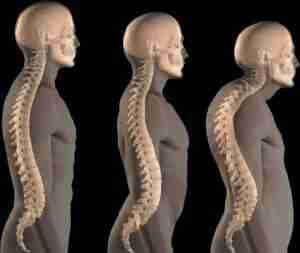 How the spine changes through life.