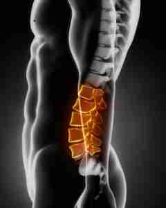 Low back pain treatment Hemel Hempstead